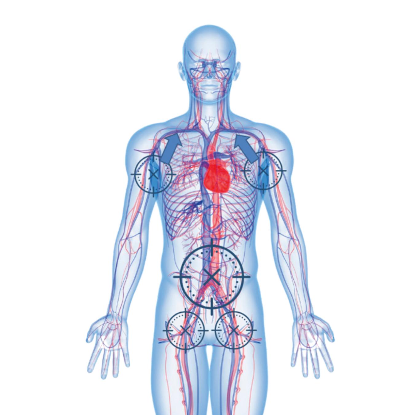 Eine Person in einer beigen Tarnuniform erhält eine medizinische Anwendung mit der DEMO Einheit Abdominal Aortic & Junctional Tourniquet-Stabilized (AAJT-S) am Oberkörper.