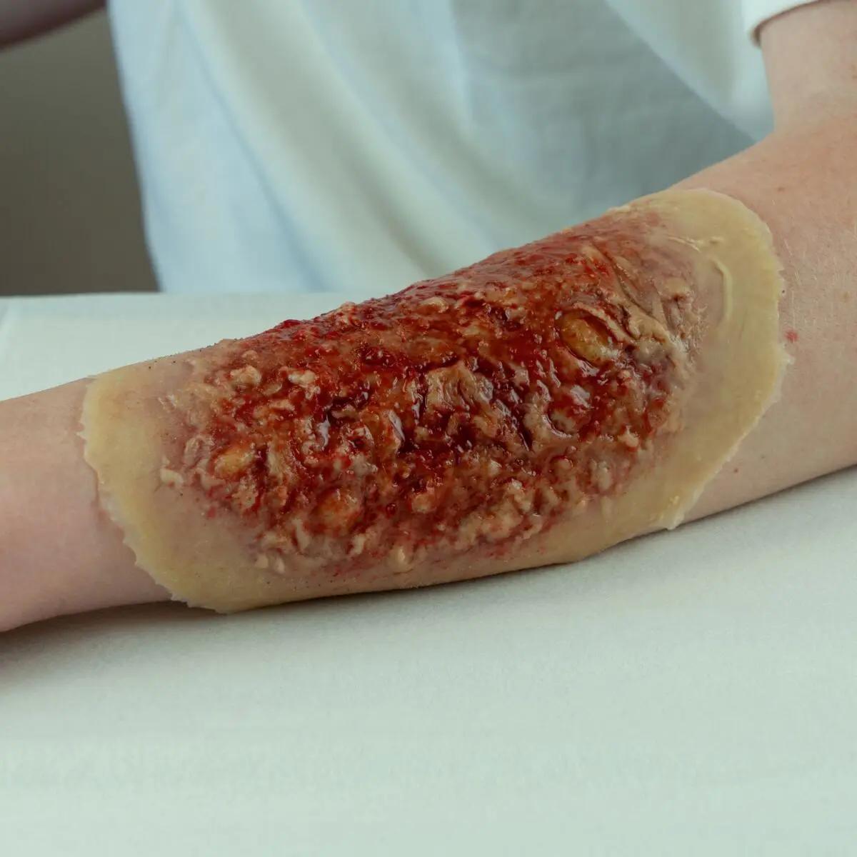 Der Unterarm trägt eine großflächige, realistische Klebewunde aus dem Techline Small Wound Kit mit rotem, braunem und strukturiertem Material.