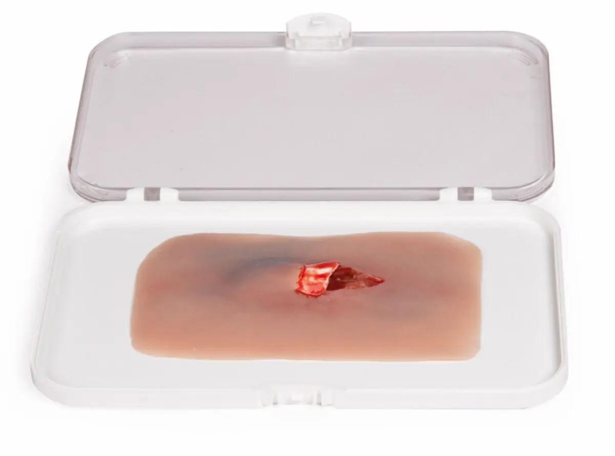 Erler-Zimmer Woundmoulage Offener Knochenbruch mit detaillierter Schusswunden-Nachbildung und rotem Gel in transparenter Aufbewahrungsbox auf weißem Tablett.