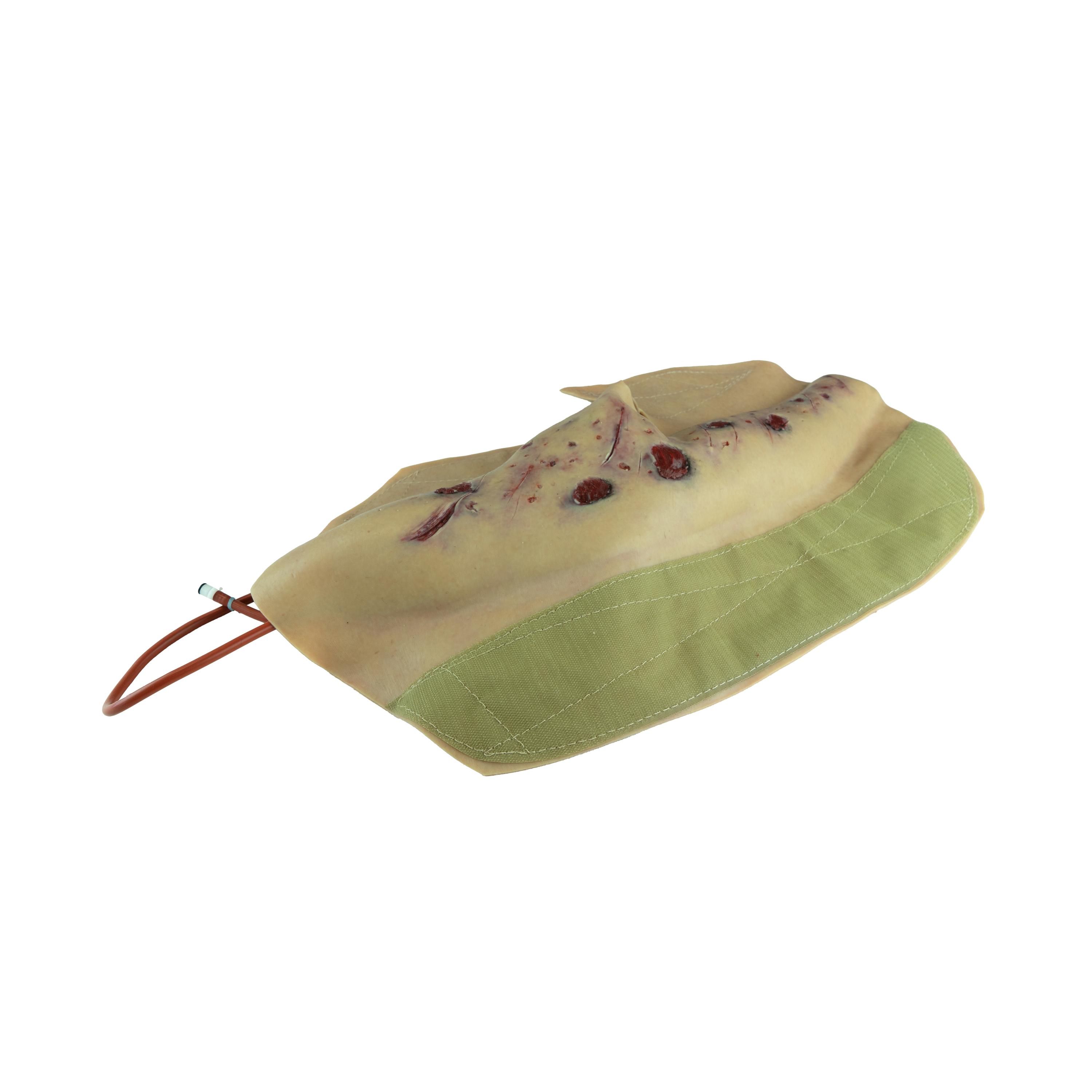 Beigefarbene Techline Moulage Schrapnelverletzung Kompletterarm (rechts) mit braun-rötlichen Wundmustern und elastischem Befestigungsband.