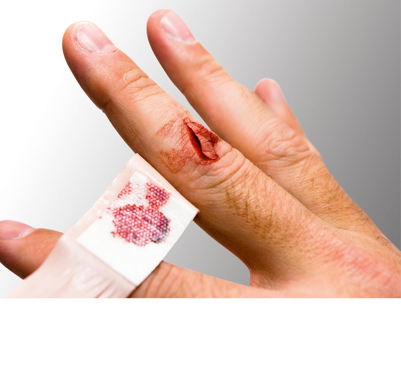 Eine Schnittwunde am Finger in Nahaufnahme. Aktuell wird das Pflaster getauscht.