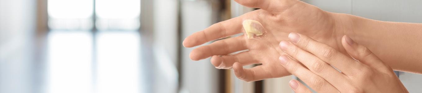 Eine Hand trägt eine blassgelbe Salbe auf die geöffnete Handfläche einer Person auf, daneben liegt die andere Hand.