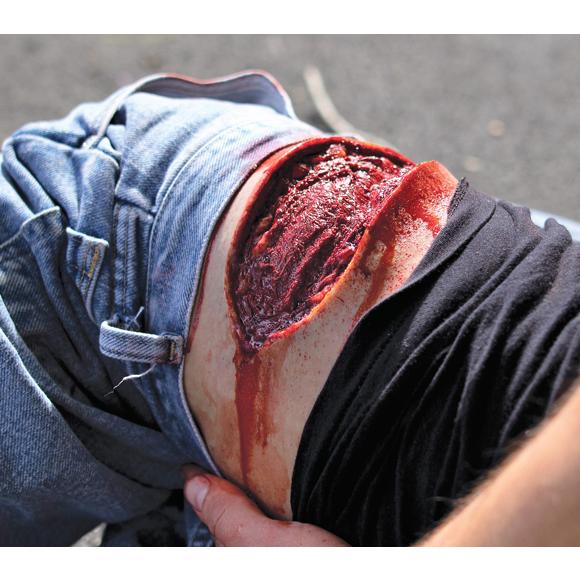 Ein angewinkeltes Bein in Jeanshose trägt die Techline Moulage Oberschenkel Platzwunde, die eine tiefe, stark blutende Platzwunde simuliert.