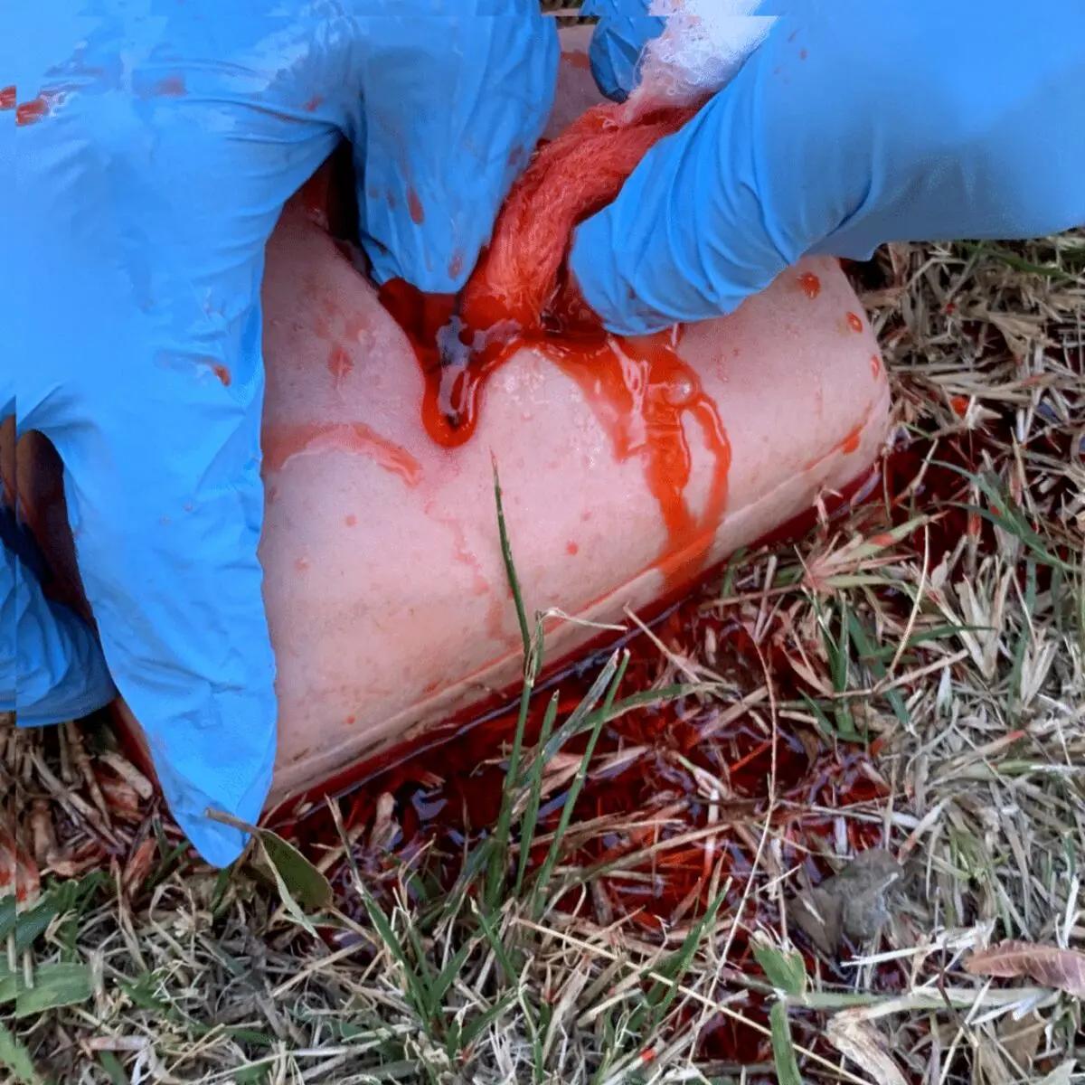 Battlefield Partners Wound Packing Trainer mit simuliertem Gewebe wird von blauen Handschuhen aus einer künstlichen Wunde in einer Trainingsszene entfernt.