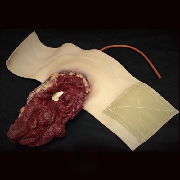 Techline Moulage Armamputation zeigt eine realistische Amputationswunde mit freiliegenden Knochen, Muskeln und Sehnen, verbunden mit Bandage und Schlauch.