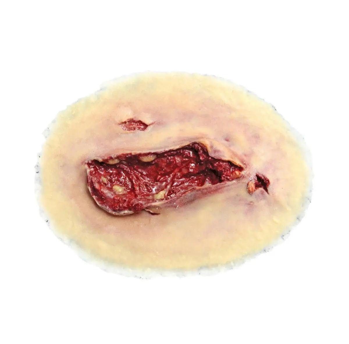 Ein Techline Moulage Schnittwunde groß selbstklebend in runder Form mit zentraler, realistisch dargestellter, geröteter Schnittvertiefung und zwei Löchern.