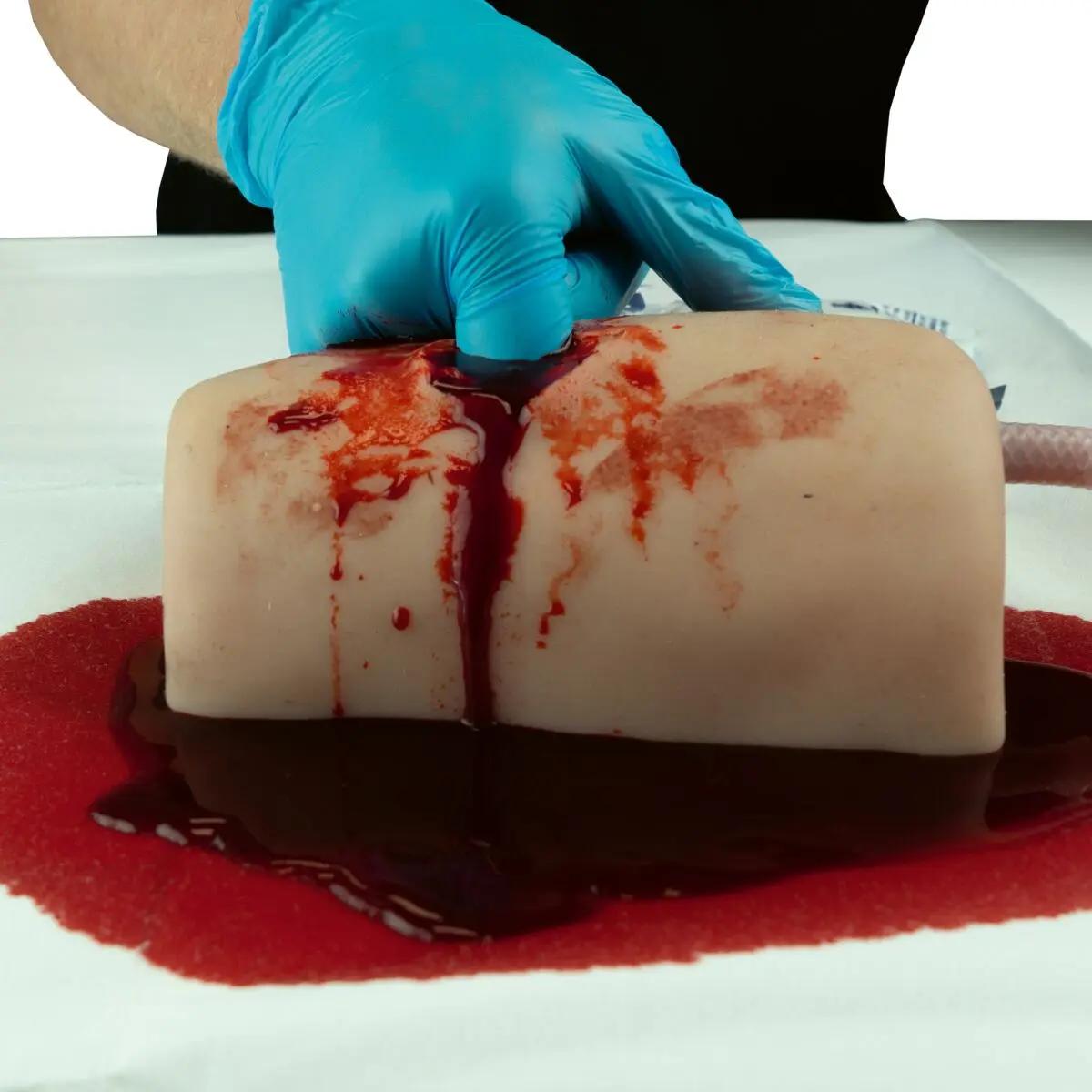 Eine Hand mit blauem Handschuh hält den TrueClot® Wound Packing Task Trainer Schusswunden, dessen Oberfläche mit realistisch wirkenden blutroten Flecken bedeckt ist.