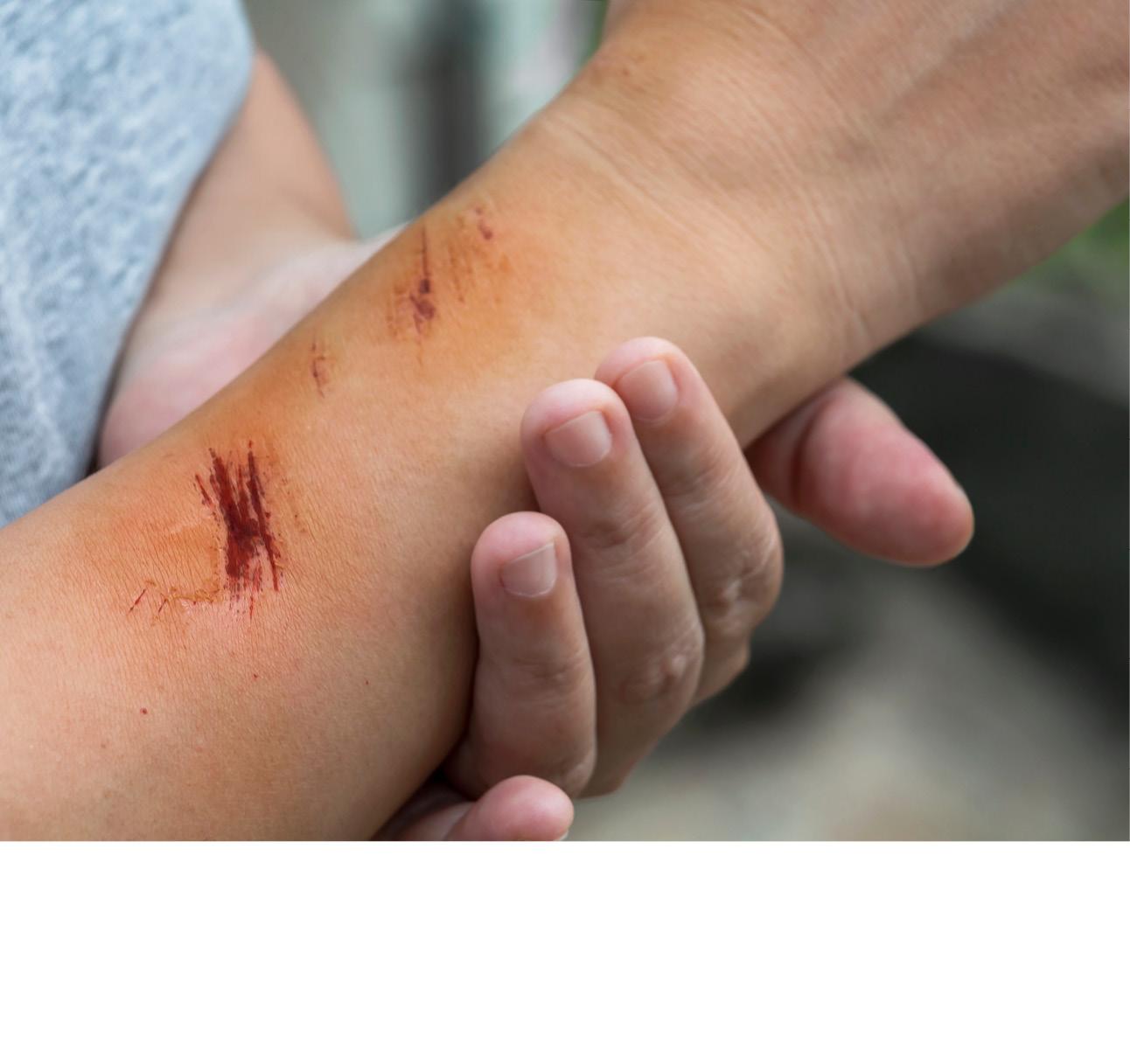 Ein Arm mit Schürfwunde in Nahaufnahme, der gerade medizinisch untersucht wird.