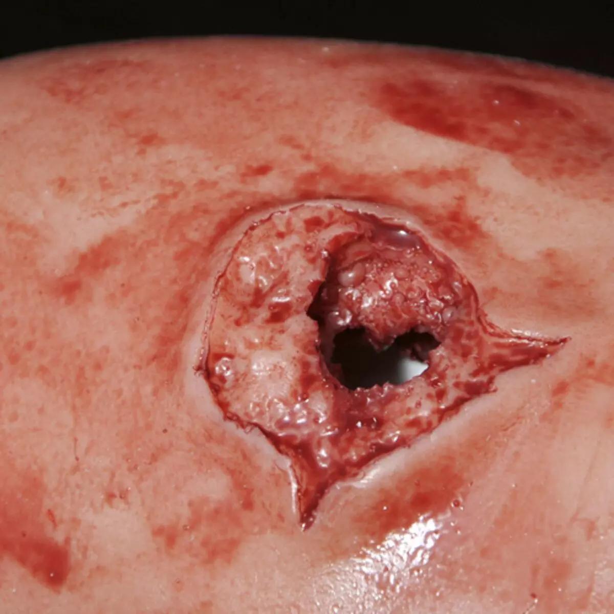 Nahaufnahme einer simulierten Schusswunde auf menschlicher Haut mit sichtbarer Blutung, passend zum TrueClot® Woundpacking Trainingssystem - Schusswunde.