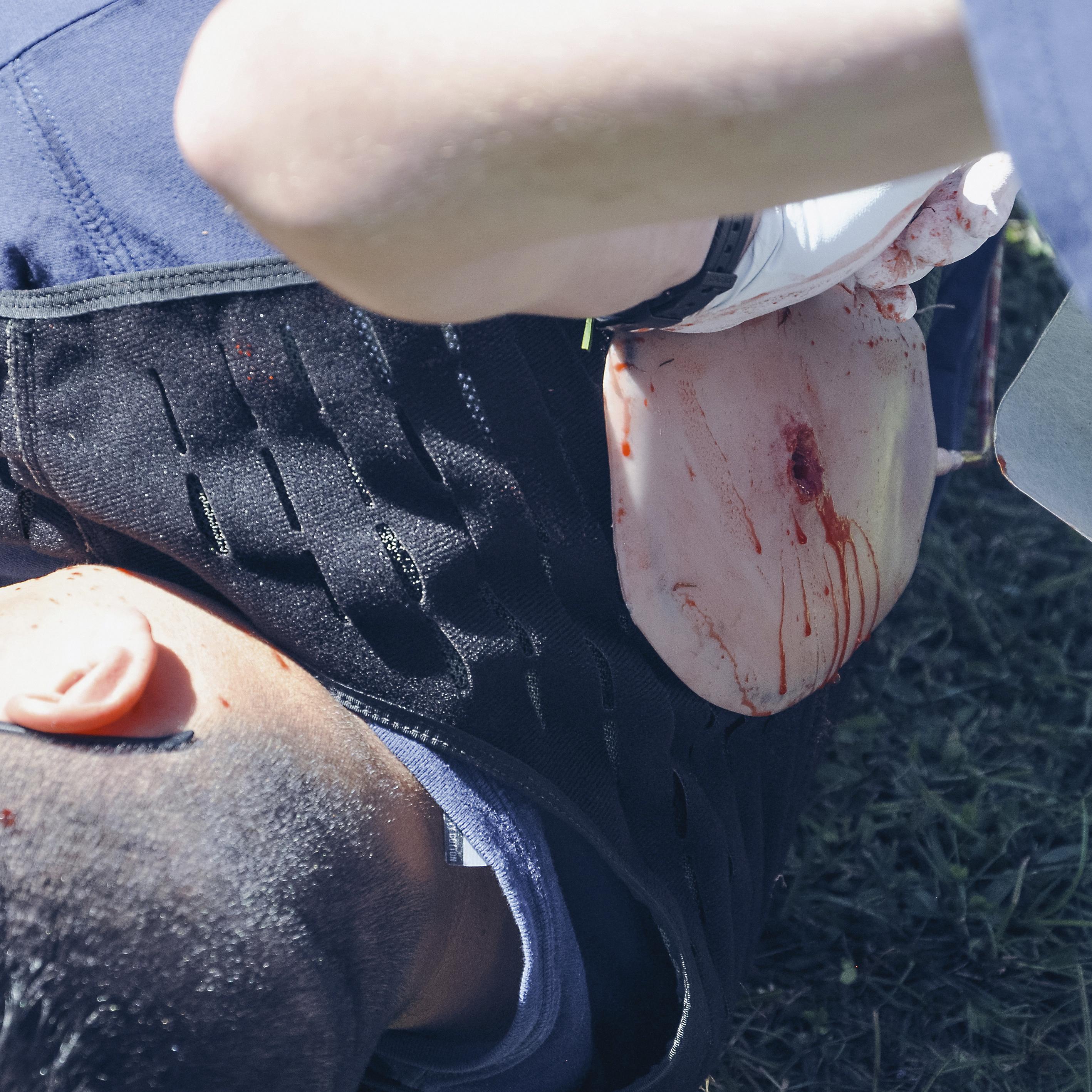 Eine Person trainiert mit dem TrueClot® Chest Seal Application Trainer, simuliert eine stark blutende Wunde am Oberkörper und erhält erste Hilfe.