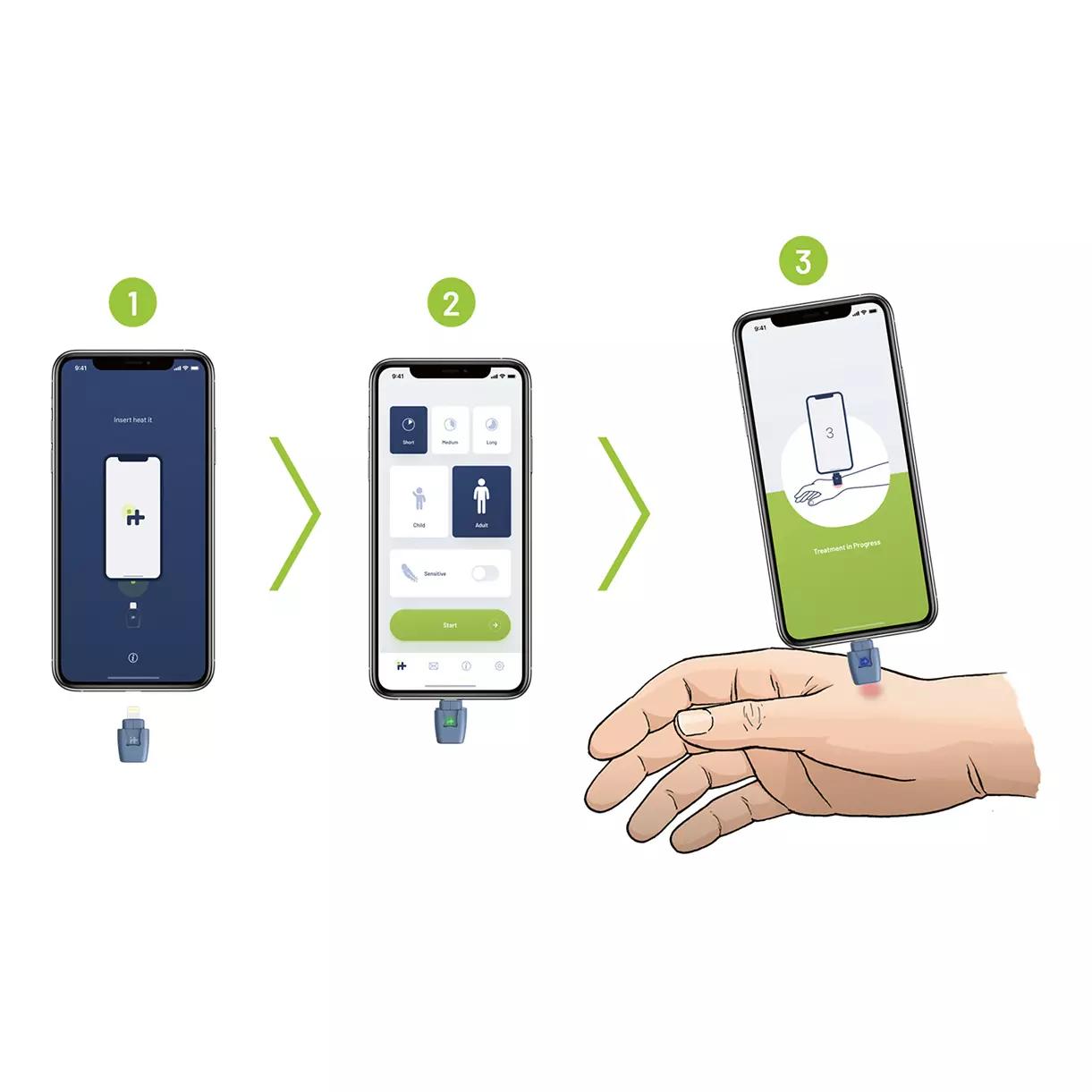 Schritt-für-Schritt-Anleitung zeigt den heat it® Insektenstichheiler - iPhone 15 & Android (USB-C) verbunden mit einem Smartphone samt App.