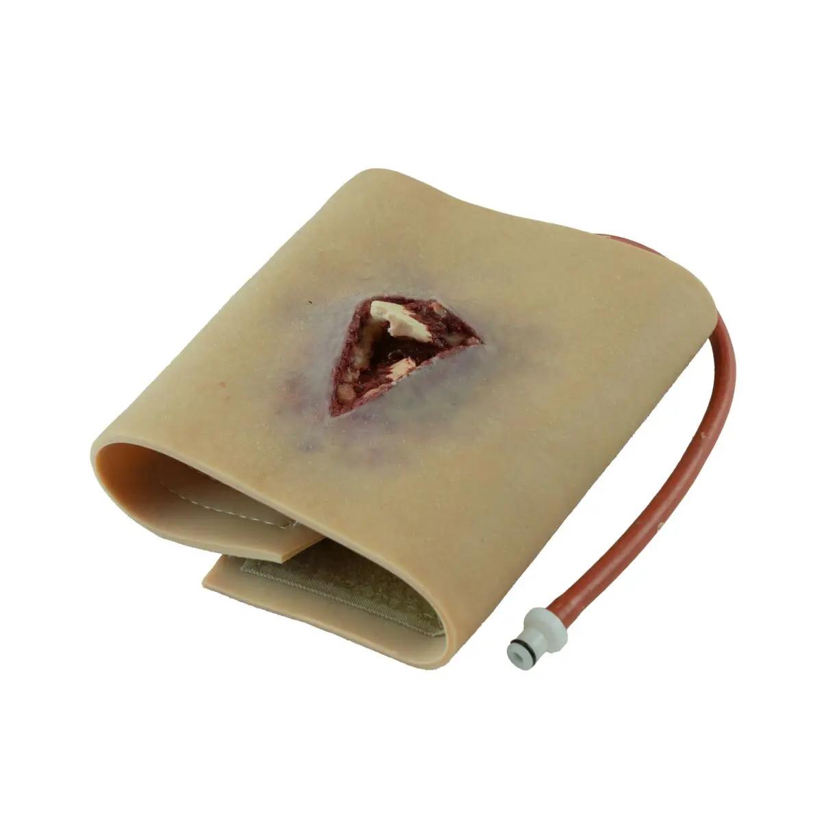 Techline Moulage Offene Fraktur-Arm zeigt einen realistischen Arm mit offener Fraktur, freiliegendem Gewebe und angeschlossenem roten Schlauch zur Simulation.