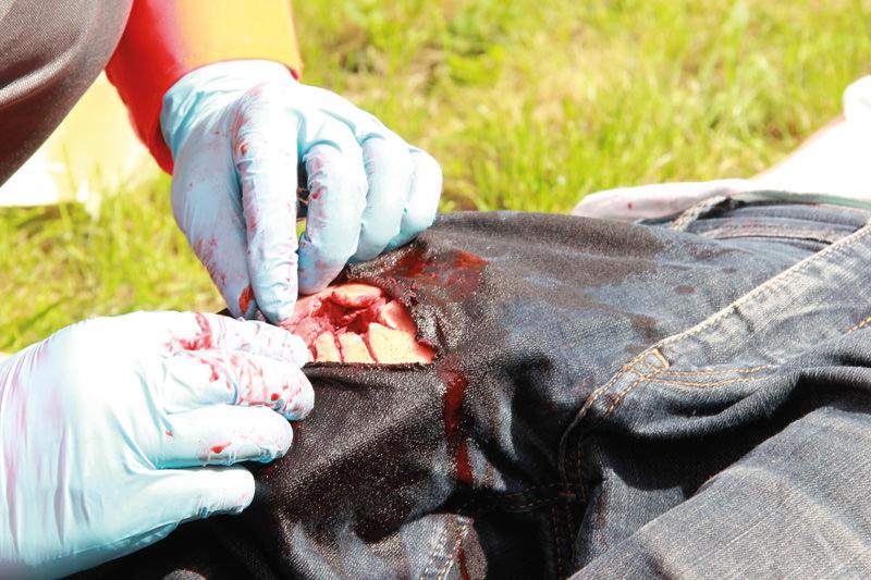 Eine behandschuhte Hand versorgt mit dem Erler-Zimmer Wound Packing Trainer eine stark blutende, realistische Schusswunde an einem knieumhüllten Bein.