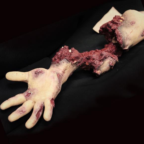 Ein realistischer Techline Moulage Teilamputation Arm mit sichtbarem hartem Knochen, blutigen Details und Schmutz für Trainingszwecke.