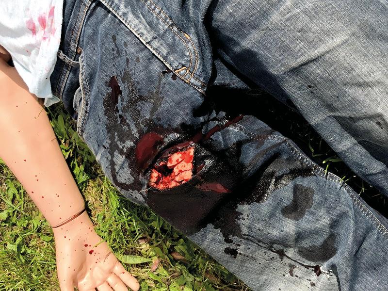 Eine Jeans mit deutlicher Schusswunde am Knie, gefüllt mit Kunstblut, dient als Übungssituation für den Erler-Zimmer Wound Packing Trainer.