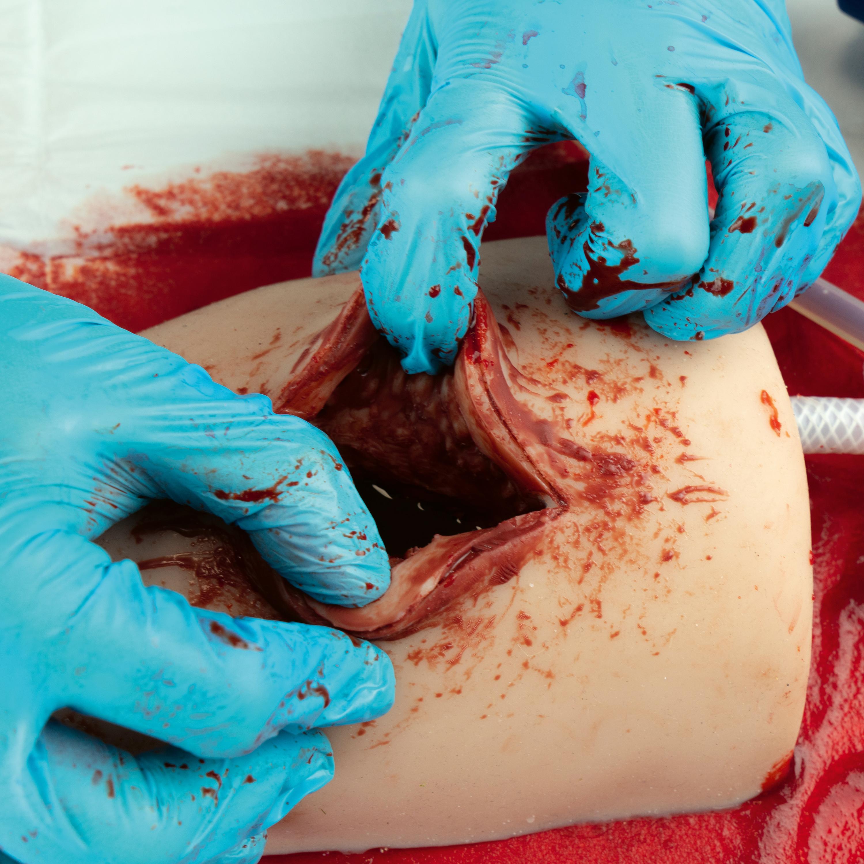 Zwei behandschuhte Hände üben mit dem TrueClot® Wound Packing Trainingssystem Schnittwunde eine blutende Schnittverletzung an einer Oberschenkelattrappe.