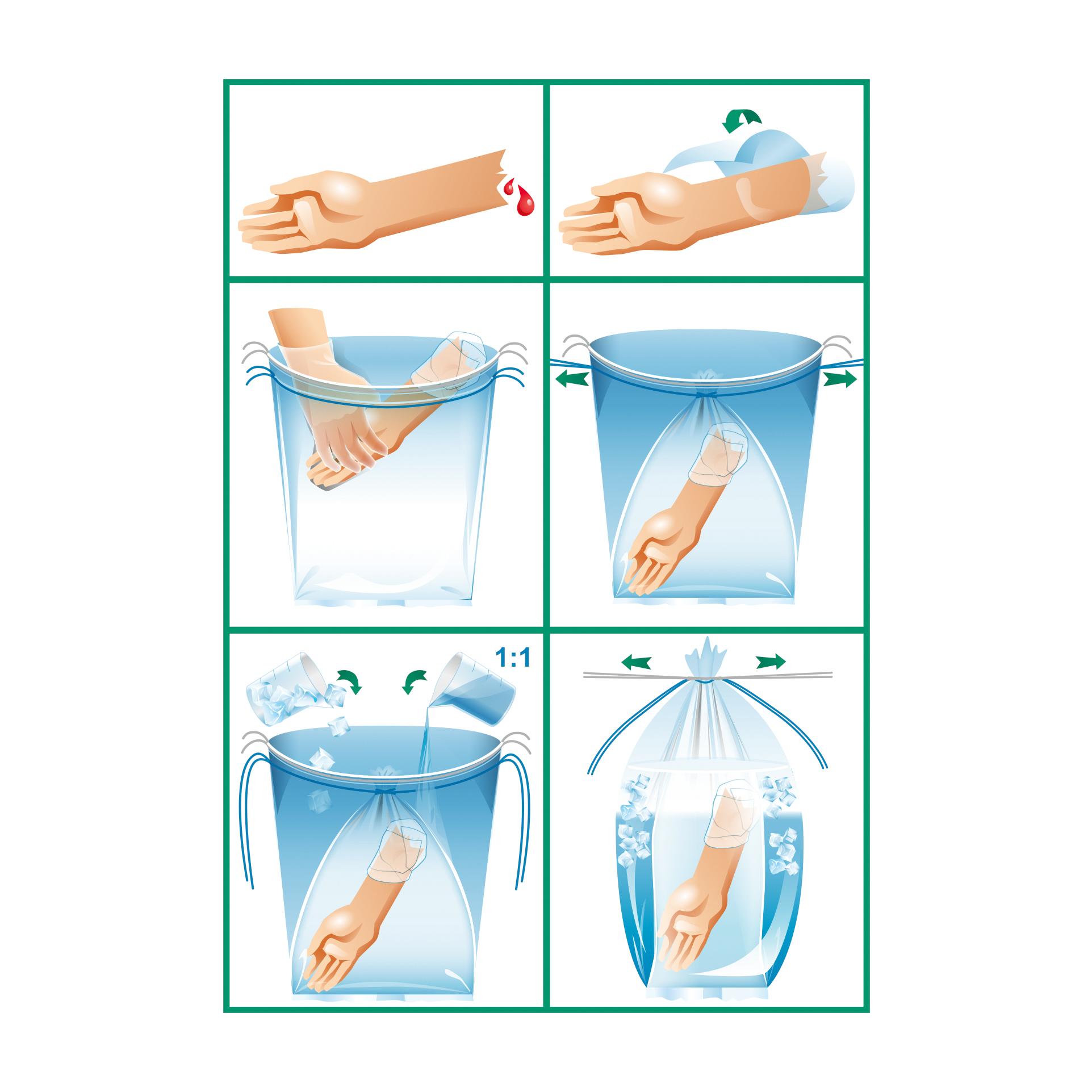 Eine Anleitung mit sechs Schritten zur Nutzung einer blauen Plastikfolie als Notfallverband für eine verletzte Arm mit Schnitt.