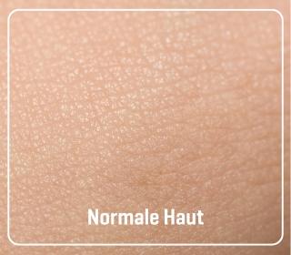 normale_haut