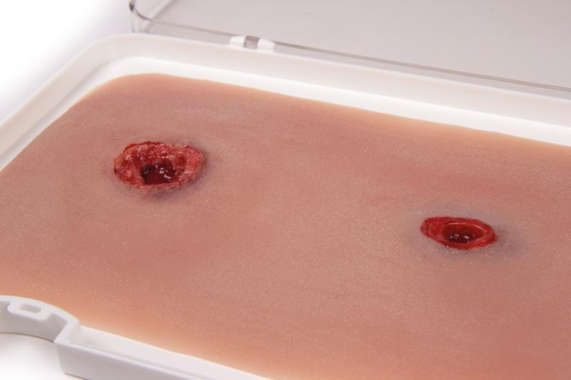 Erler-Zimmer Woundmoulage Schusswunde Arm mit Blutungsfunktion in Kunststoffschale mit zwei pinken Pads, zeigt realistische Ein- und Ausschusswunde mit Blutung.