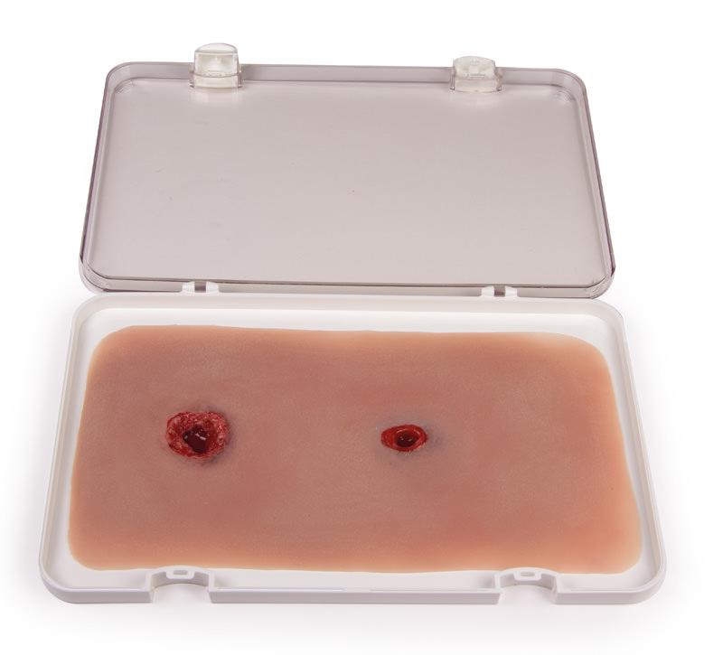 Ein geöffneter Tray zeigt die Erler-Zimmer Woundmoulage Schusswunde Arm mit Blutungsfunktion mit realistischen Ein- und Ausschusswunden sowie Blutspur.