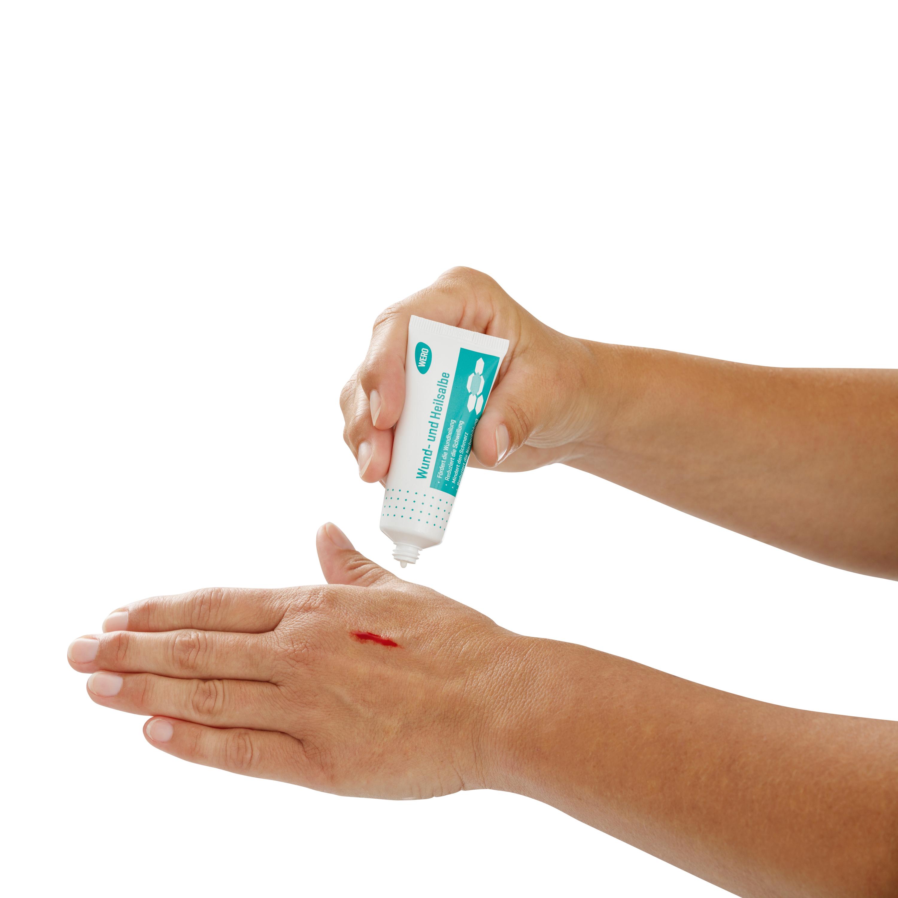 Eine Person trägt mit einer weißen Tube WERO Wund- und Heilsalbe auf eine gerötete, heilende Wunde auf dem Handrücken auf; die Salbe reduziert Schorf- und Narbenbildung, lindert Schwellungen und ist auch bei Prellungen geeignet.