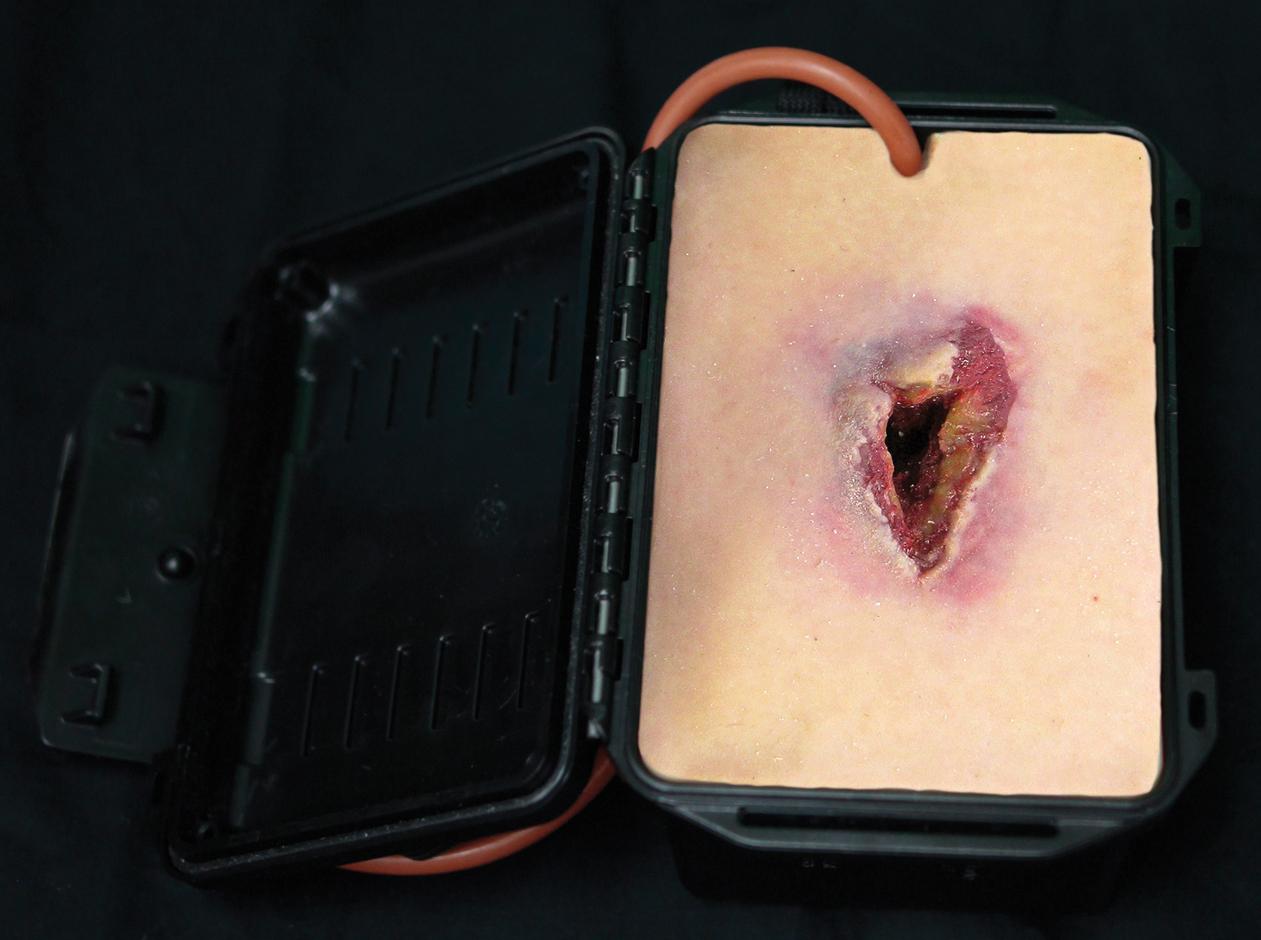 Techline Schrapnellwunde in einer Box mit simulierter Wunde, beigefarbenem Trainingsmaterial und angeschlossenem roten Schlauch zur Blutungssimulation.