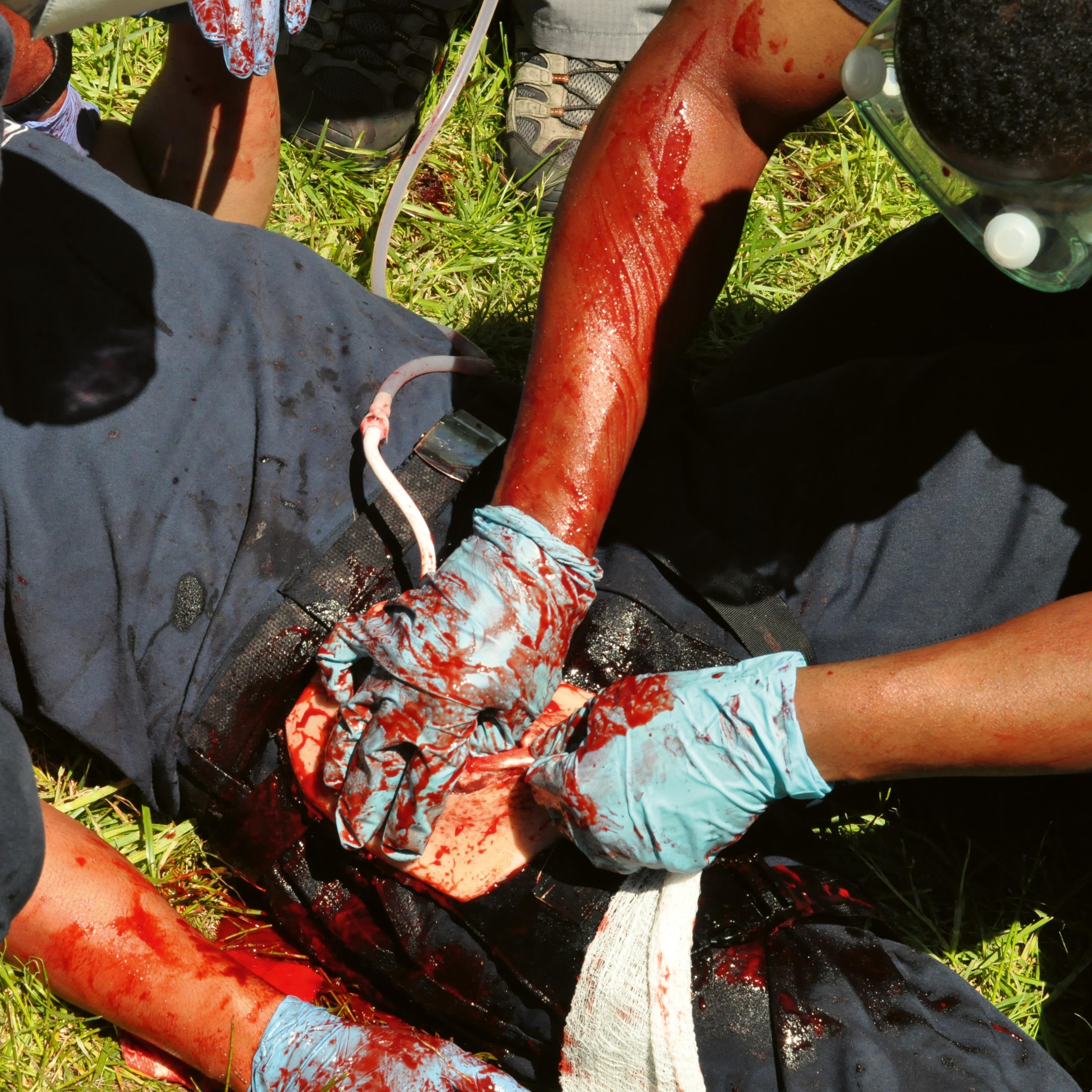 Zwei Personen üben mit dem TrueClot® Leisten Wound Packing Trainer das Stoppen einer simulierten Leistenblutung unter realitätsnahen Bedingungen.