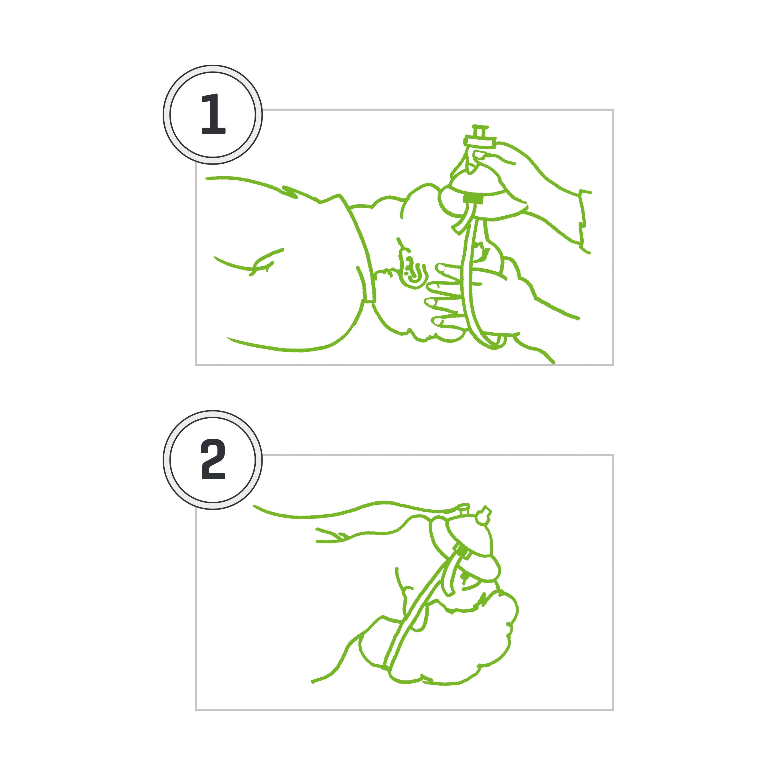 Zwei Illustrationen zeigen das Einführen einer nasalen und oralen Kanüle durch Hände in Nase und Mund einer Person als Schritt-für-Schritt-Anleitung.