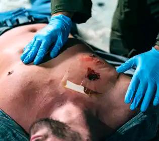 Chest Seal Anwendung – Versorgung von Thoraxverletzungen