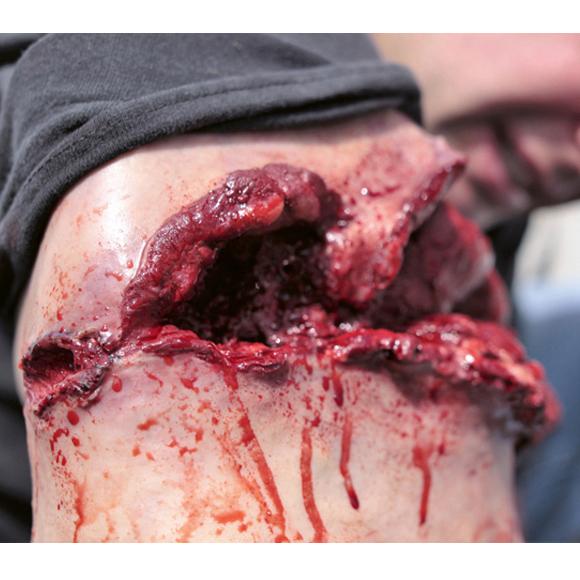 Techline Moulage Schusswunde Bizeps zeigt eine realistisch gestaltete Schusswunde am Arm mit sichtbarem Fett-, Muskel- und Knochengewebe.