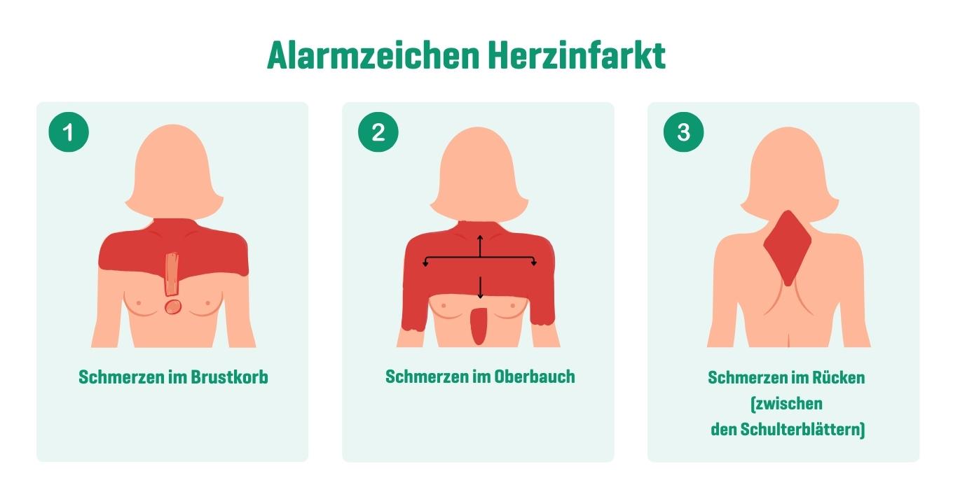 Infografik zeigt drei Herzinfarkt-Alarmzeichen: Brustschmerzen, Oberbauchschmerzen und Rückenschmerzen zwischen den Schulterblättern.