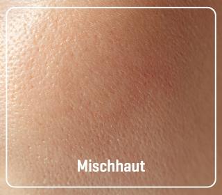 mischhaut
