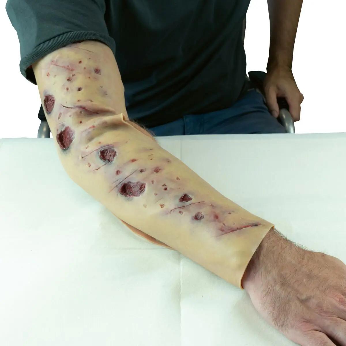 Ein Techline Moulage Schrapnelverletzung Kompletterarm (rechts) zeigt realistische, oberflächliche Schrapnellwunden an einer naturgetreuen, beigen Prothese.