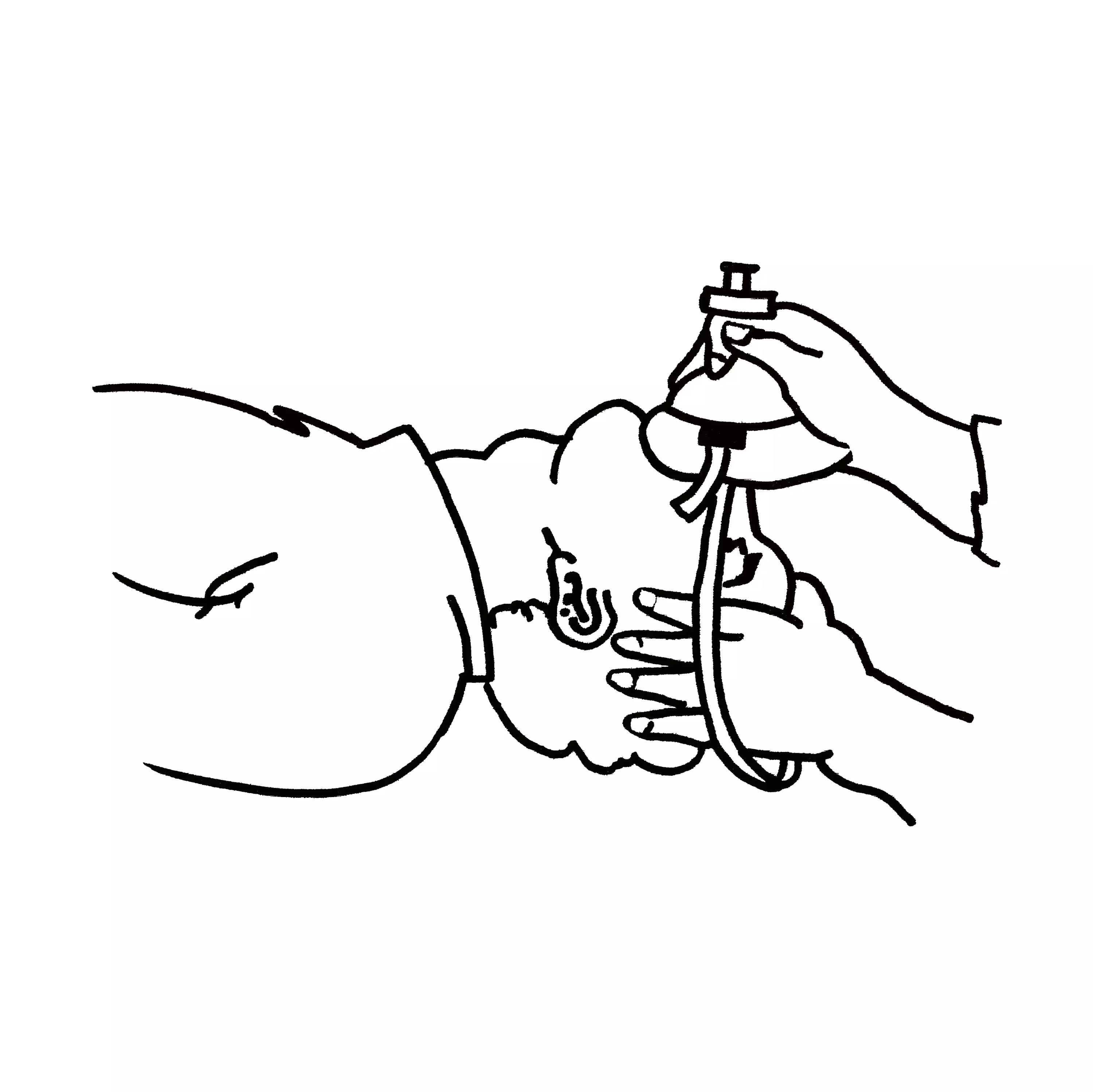 Eine Hand hält eine Maske mit Schlauch, bereit zur Beatmungshilfe bei einer anderen Person, als schwarz-weiße Illustration dargestellt.