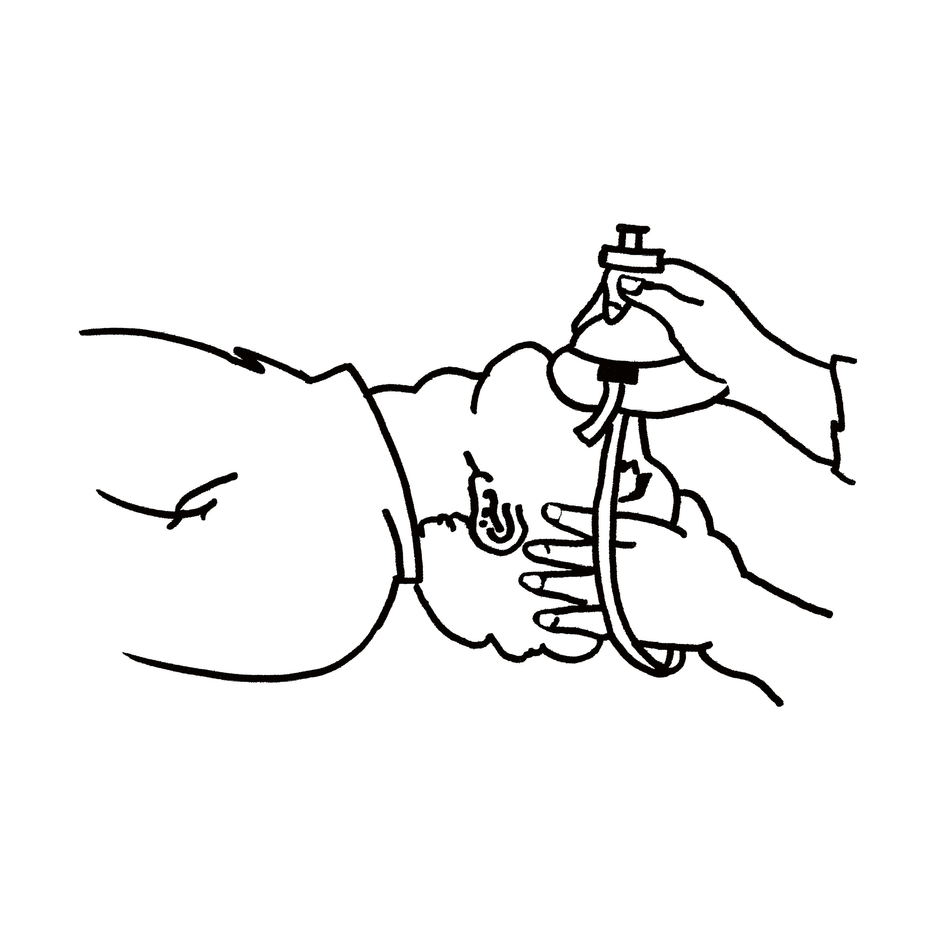 Eine Hand hält eine Maske mit Schlauch, bereit zur Beatmungshilfe bei einer anderen Person, als schwarz-weiße Illustration dargestellt.