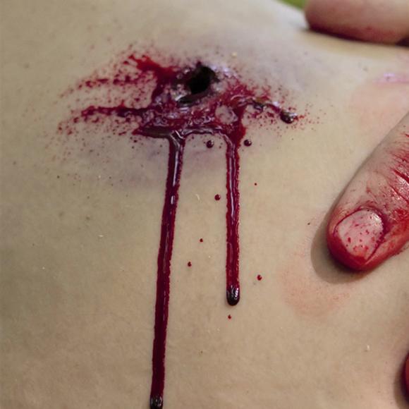 Eine verletzte, trockene Haut mit blutender, zentraler Wunde und einem Finger mit rotbraun lackiertem Nagel daneben.