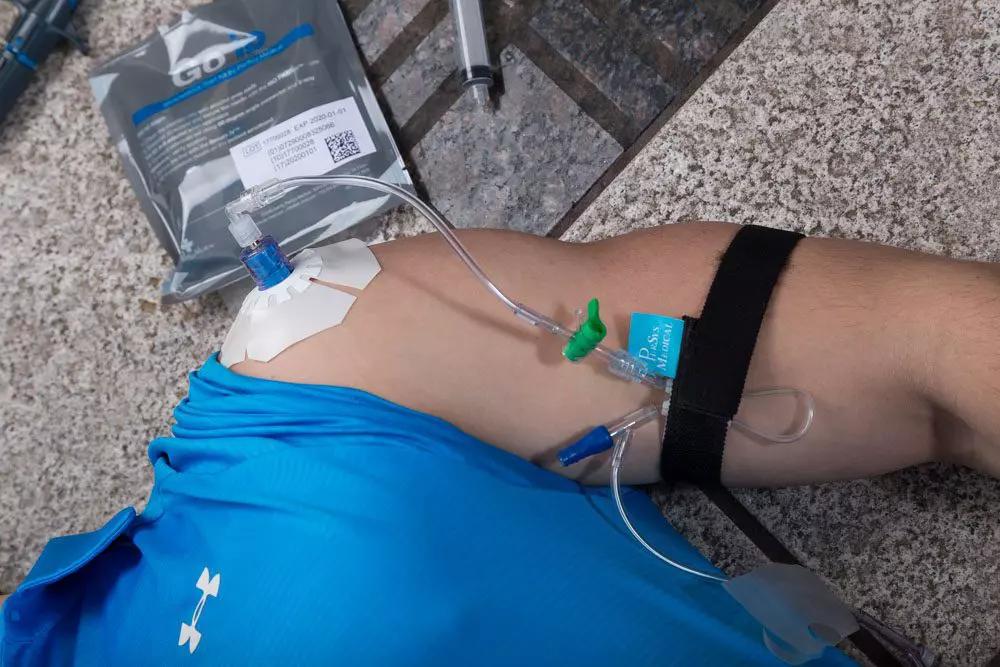 Der NIO-Adult - Intraossärer Zugang ist am Oberarm einer Person angebracht, mit schwarzem Bandolier, flexiblem Schlauch und sichtbarer Ventiltechnik.