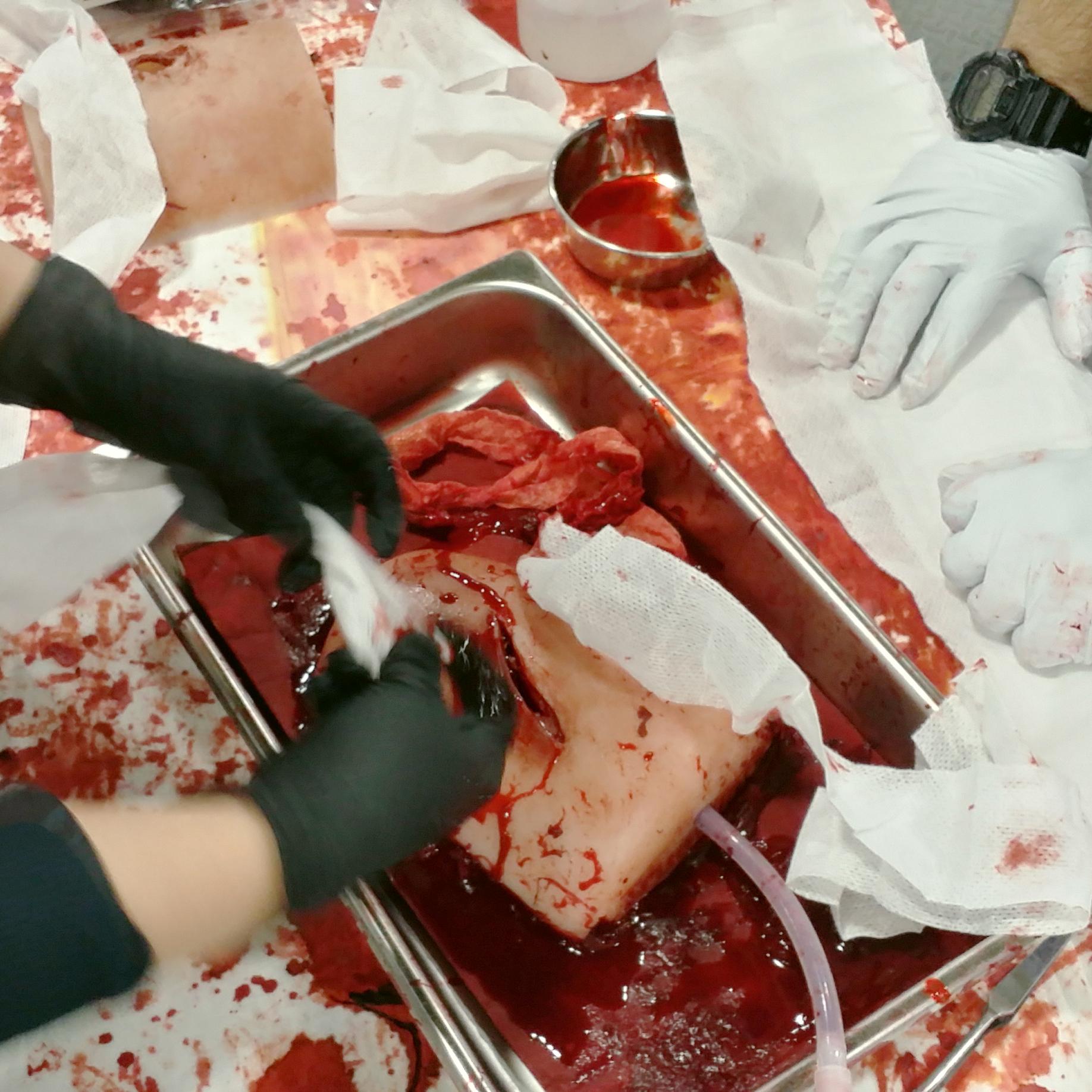 Ein anatomisches TrueClot® Wound Packing Trainingssystem Schnittwunde Herzmodell mit realistischer Blutung, Trainingsgaze und angeschlossener Infusionsleitung.