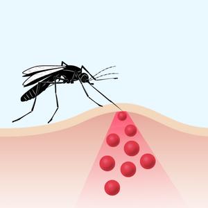 Ein schwarzer Moskito fliegt mit ausgestrecktem Rüssel über rote, geschwollene Mückenstiche auf heller Haut.