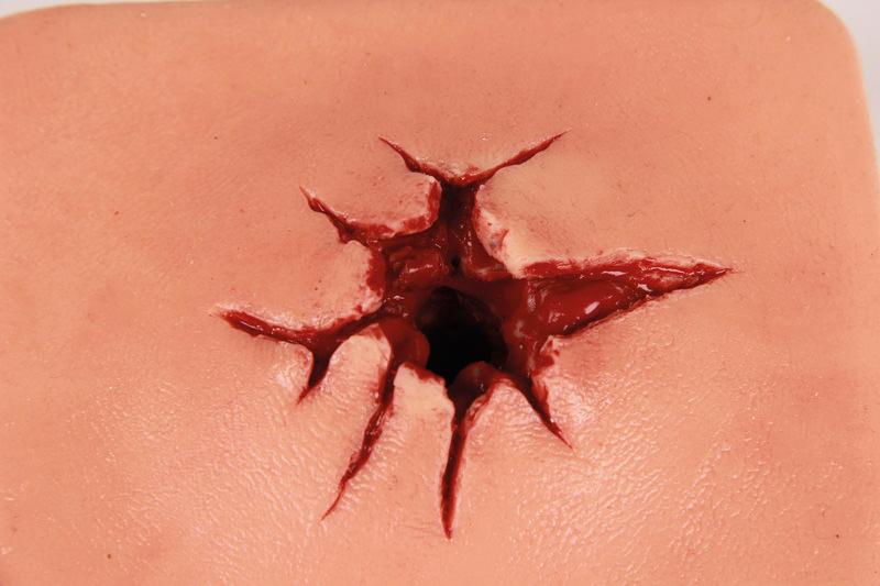 Großkalibrige, runde Schusswunde mit tiefroten Frakturen auf blassem Kunsthautmodell des Erler-Zimmer Wound Packing Trainer aus strapazierfähigem Silikon.