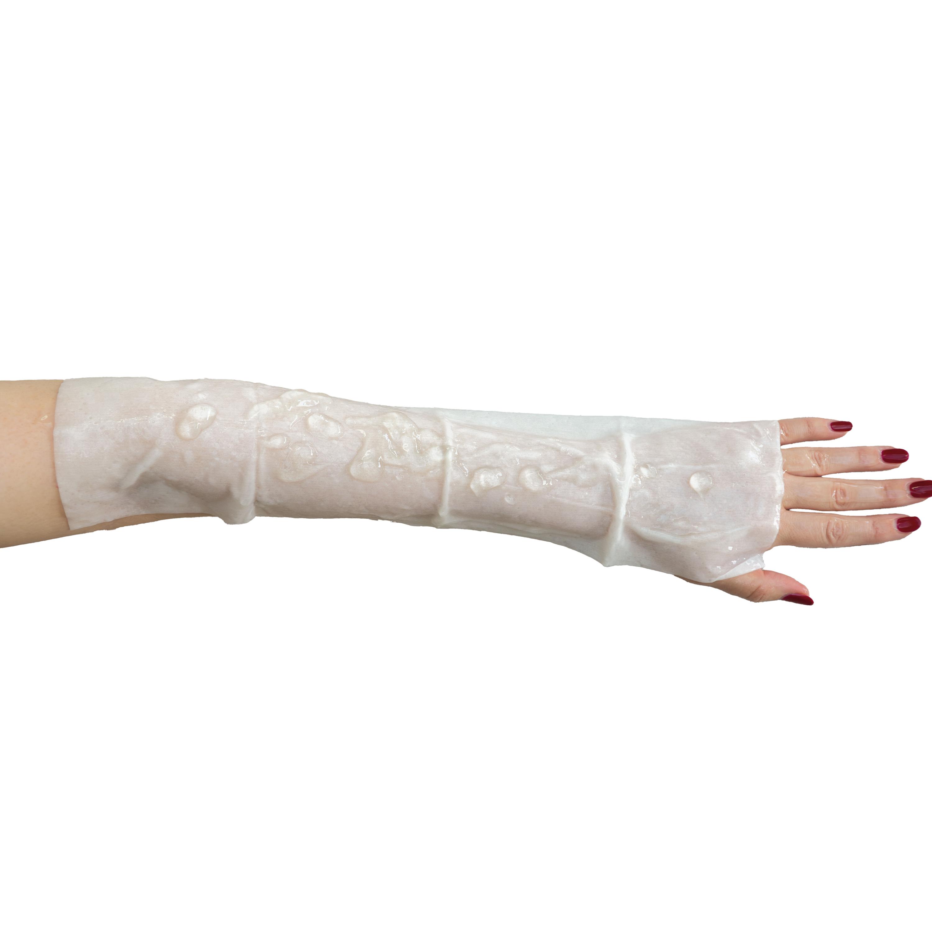 WERO BurnAway® Verbrennungskompresse, flexibel um das Handgelenk gewickelt, mit heller, punktförmiger Oberfläche, deckt die Haut vollständig ab.