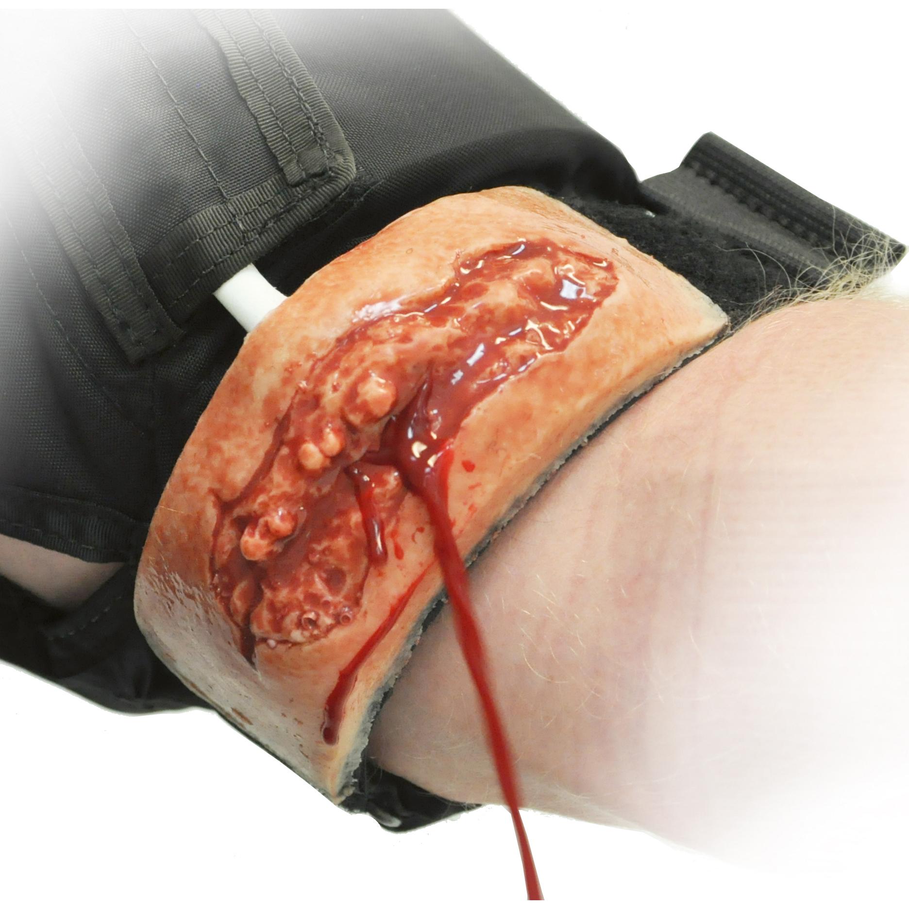 Realistische Wundsimulationsvorrichtung mit blutender Schnittwunde, weißem simulierten Fremdkörper und schwarzer flexiblem Band auf Handgelenk