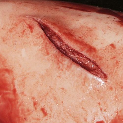 Nahaufnahme einer simulierten Schnittwunde am TrueClot® Wound Packing Trainingssystem Schnittwunde mit unregelmäßigem, blutähnlichem Riss auf heller künstlicher Haut.
