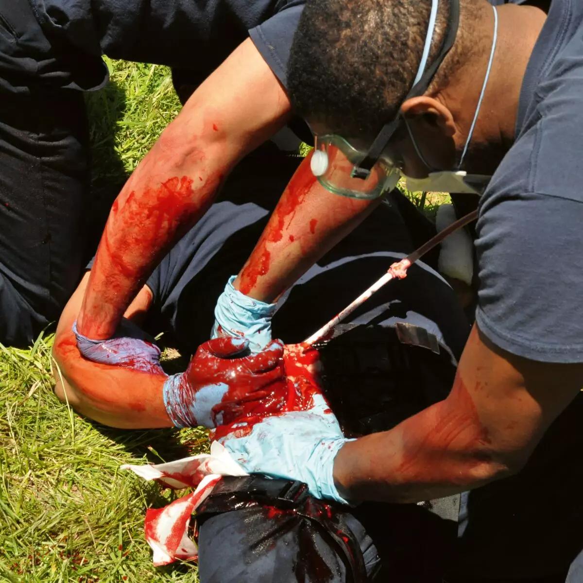 Eine Person demonstriert die Anwendung des TrueClot® Leisten Wound Packing Trainer an einer verletzten Übungspuppe mit simulierten Blutungen.