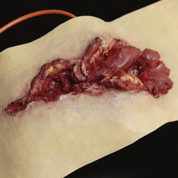 Ein Techline Moulage Schusswunde Bizeps zeigt eine realistisch gestaltete, offene Wunde mit sichtbarem Fett-, Muskel- sowie freigelegtem Knochen- und Sehnengewebe.