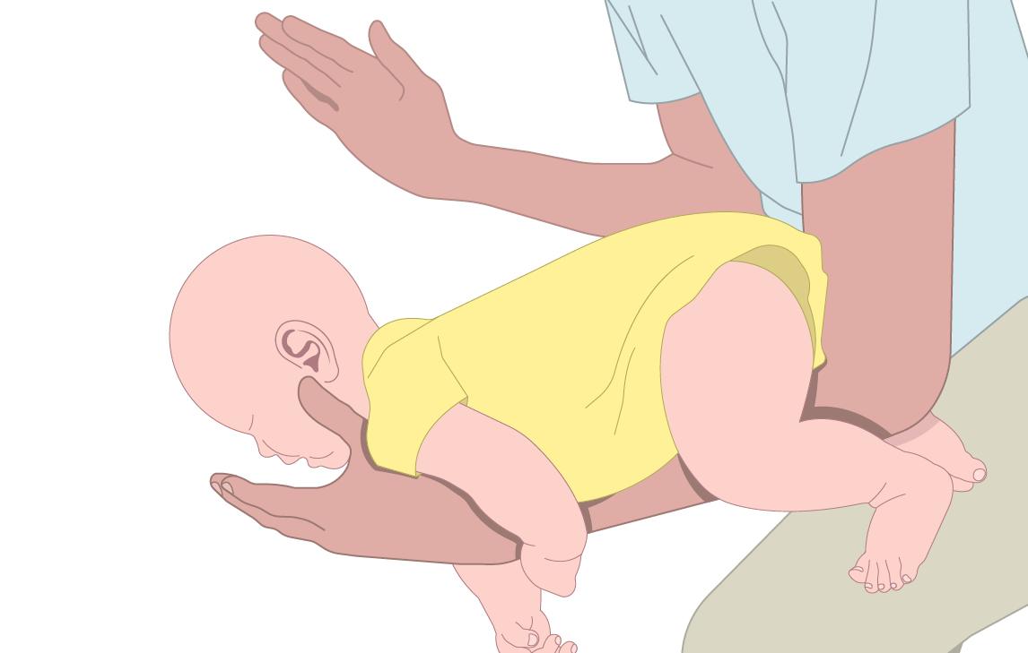 Ein Baby im gelben Strampler wird sicher von einem Erwachsenen gehalten, dessen Hand sanft den Babyrücken stützt.