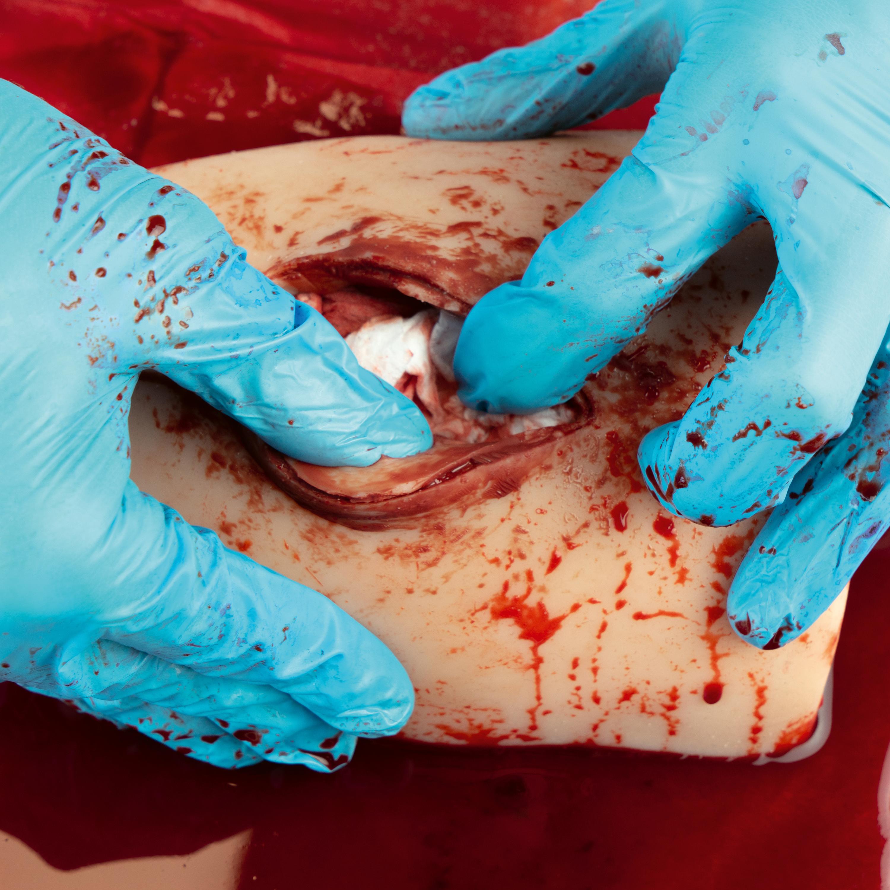 Zwei behandschuhte Hände üben an einem TrueClot® Wound Packing Task Trainer für Schnittwunden das Verschließen einer blutenden Schnittwunde am Dummy.