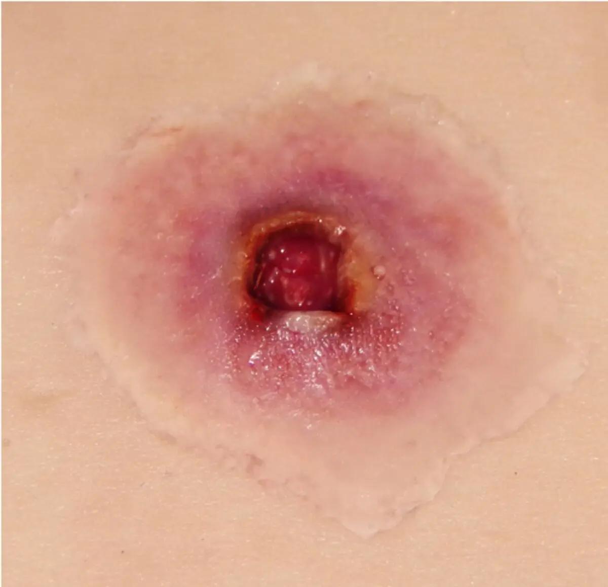 Nahaufnahme einer Techline Moulage Schusswunde Eintritt klein selbstklebend, rund mit sichtbaren Blut- und Lymphgefäßen, auf heller Haut platziert.