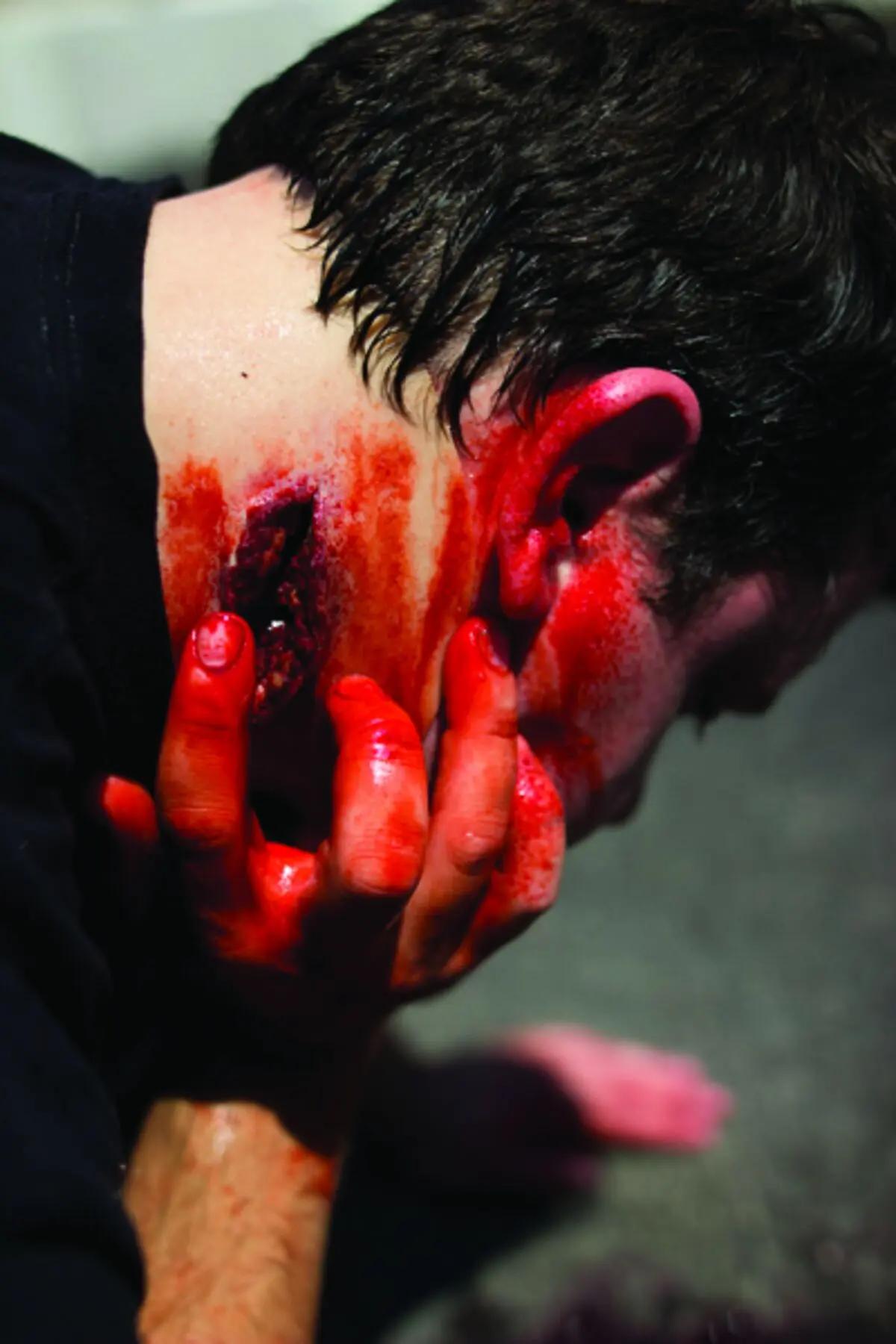 Im Vordergrund liegt eine Person mit gesenktem Kopf, am Hals ist die realistische Techline Moulage Nacken Wunde mit simuliertem Blut und freigelegtem Gewebe zu sehen.