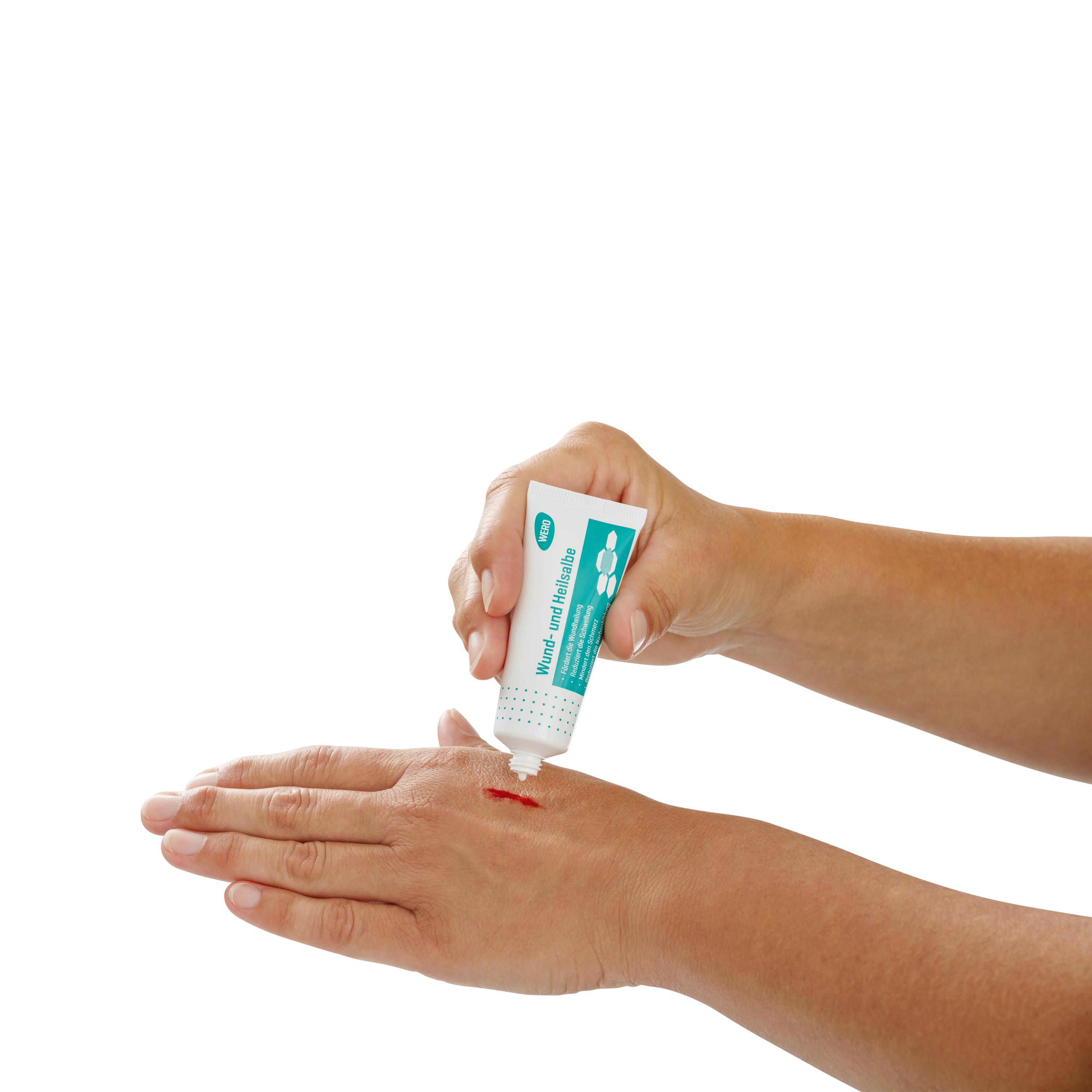 Zwei Hände tragen mit der WERO Wund- und Heilsalbe aus der Tube eine dünne Schicht auf eine kleine Hautverletzung auf.